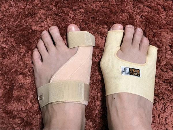 外反母趾 グッズいろいろ試してみた